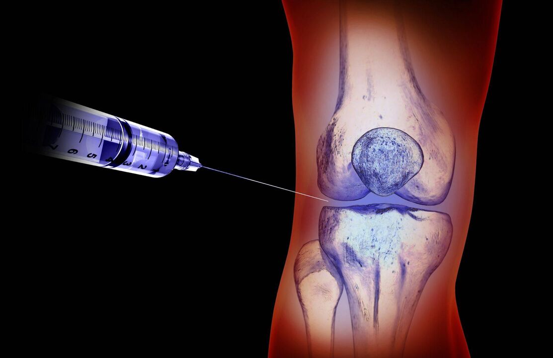 Intra-articular injections to treat arthropathy