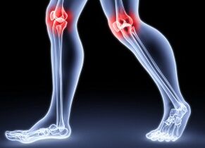 Causes of joint development of knee joints