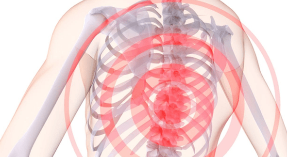 Spinal pain caused by thoracic osteochondrosis
