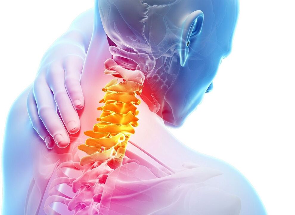 cervical osteochondrosis